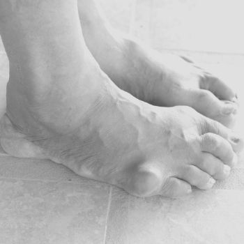 gout