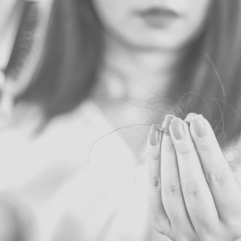 hair loss